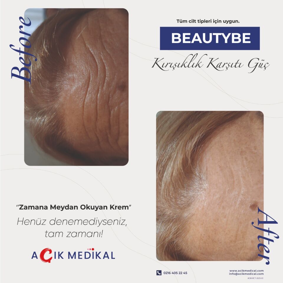 BeautyBe Anında Etkili Kırışıklık Karşıtı Güç Kremi
